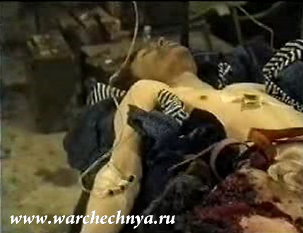 Наши раненые